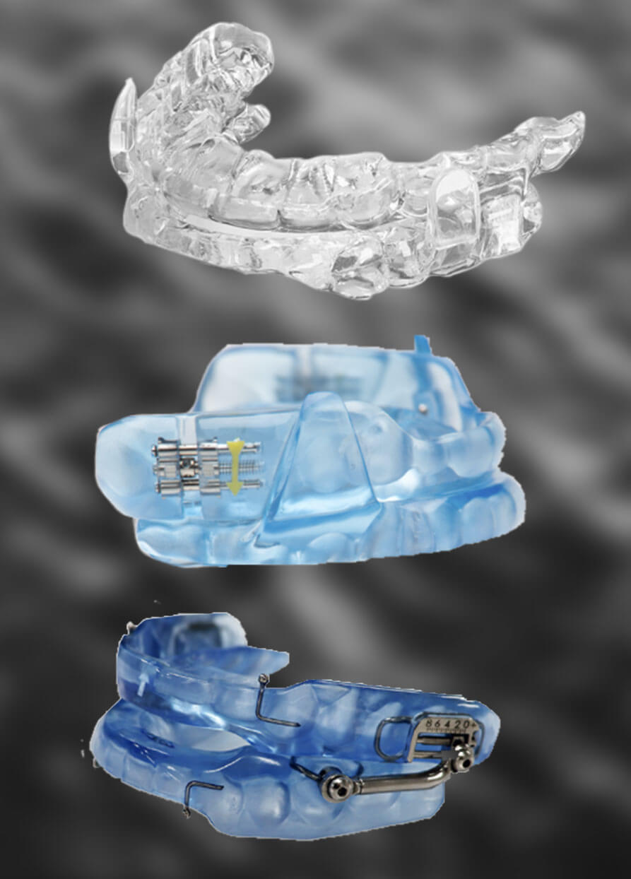 Lubbock Texas CPAP Alternative